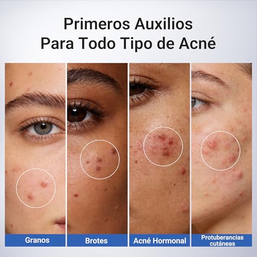 Dr.Leo Suero Anti-Acné con Ácido Salicílico 1.8% Loción secante para granos piel sensible propensa al acné Con Niacinamida alivio rápido atenúa manchas ideal para brotes nocturnos y menstruales 20 ml