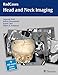 Head and Neck Imaging