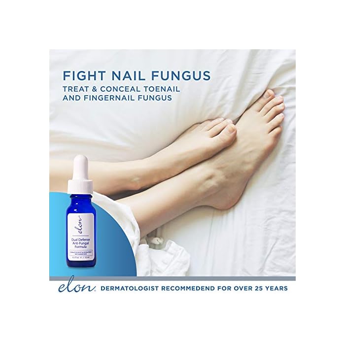 Elon Dual Defense AntiFungal Formula 25 Undecylenic Acid Treat