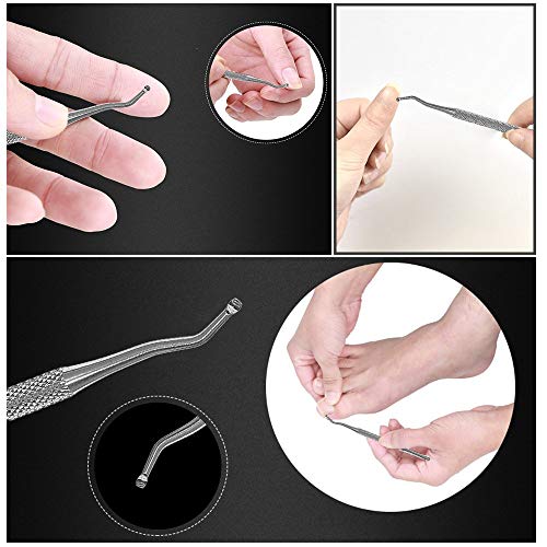 Ingrown Toenail Pedicure Tool Straightening Clip Curved BS Brace for
