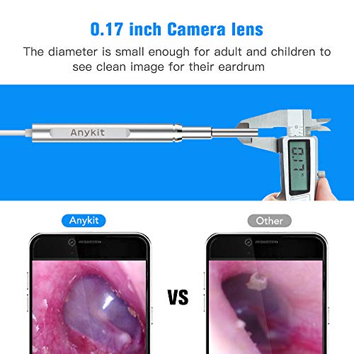 Otoscope iPhone, Anykit Upgraded 4.3mm 720P HD Ear Scope Camera Digital Otoscope with 6 LED Lights, Earwax Removal Tool and Specula for iPhone and Android Smartphone