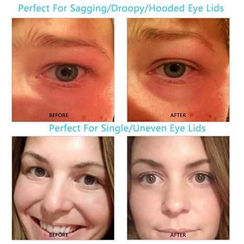 3D Lace Eye Lids Lift Stickers, Natural Invisible Slim One-sided Double Eyelid Tapes, Medical Fibre, Instantly Eyelids Lift Without Surgery, Perfect for Uneven/Single/Droopy/Hooded/Sagging Eyelids