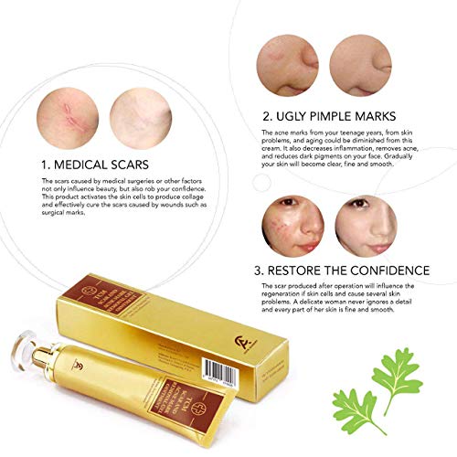 pimple marks removal cream for men