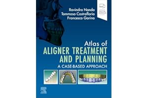 Atlas of Aligner Treatment and Planning: A Case-Based Approach