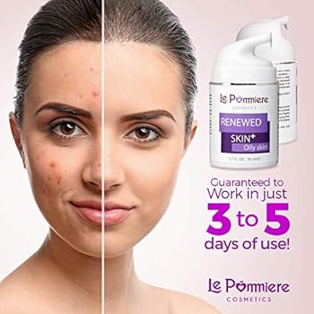 forehead pimples cream