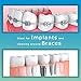 SmarToiletries Water Flosser Professional Cordless 3-Mode Rechargeable Waterproof Oral Irrigator High Capacity Water Tank 4 Jet Tips … (Classic White)