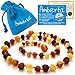 Amber Teething Necklace for Babies Amberta - Teething Discomfort & Drooling Relief, Anti Inflammatory, Immune System Boost - 12.6 inches, 100% Pure Amber, Raw, Twist-in Screw Clasp, Handmade