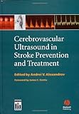 Cerebrovascular Ultrasound in Stroke Prevention and Treatment by Andrei V. Alexandrov, James C. Grotta