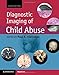 Diagnostic Imaging of Child Abuse