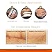 Embrace Active Scar Defense for New Scars, FDA-Cleared Medical-Grade Silicone Scar Sheets for Hypertrophic & Keloid Scar Treatment, 1.6 Inch, Small, 60-Day Supply