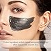 Vikeepro Dead Sea Mud Mask Blackhead Remover Facial Treatment Deep Cleansing for Face, Acne, Oily Skin - Exfoliation Minimizes Pores Reduces Acne Wrinkles