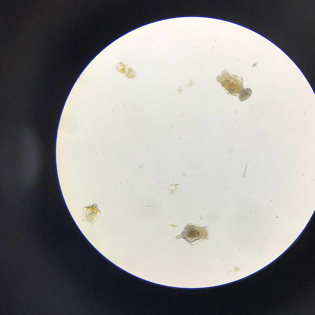 GreenWaterFarm Rotifers Brachionus calyciflorus Pallas Eggs Live Fish Food for Hatching and Culture Suitable for Feed Betta Fish