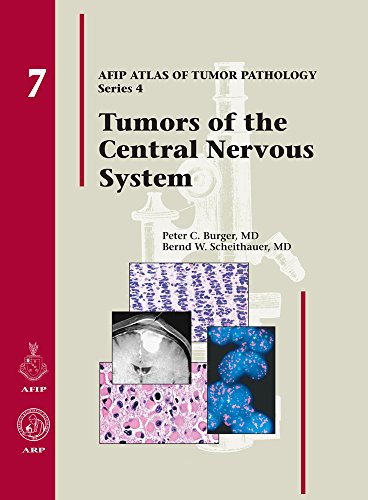 Tumors of the Central Nervous System (Afip Atlas of Tumor Pathology)