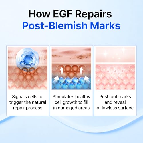 DearKlairs EGF Serum - Blue Youth Activating Drop, 1.69 Fl Oz | Barrier Repair & Post-Blemish Marks, Sensitive Skin-Friendly, Daily Calm & Soothe, Korean EGF serum