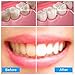 Water Dental Flosser 600ml Capacity IPX7 Waterproof Oral Irrigator FDA Approved 10 Levels Adjustable with 7 Jet Tips Professional Portable for Braces and Teeth