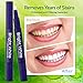 Teeth Whitening Pen (2 Pack), Safe 35% Carbamide Peroxide Gel, 20+ Uses, Effective, Painless, No Sensitivity, Travel-Friendly, Easy to Use, Beautiful White Smile, Natural Mint Flavor