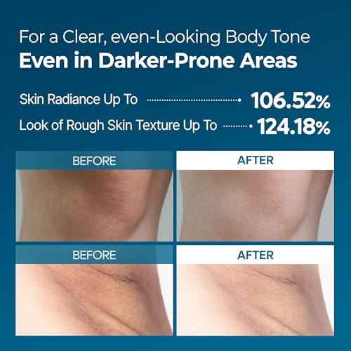 Dr.Melaxin Tranexamic Acid Body Exfoliating Spray – Brightening Treatment with Niacinamide for Uneven Skin Tone & Smooth Skin, 200ml