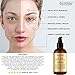 Super Vitamin C Serum for Face - HUGE 2 FL OZ - 6X Stronger Than 20% Serum - Highest Professional Grade w/ L Ascorbic Acid