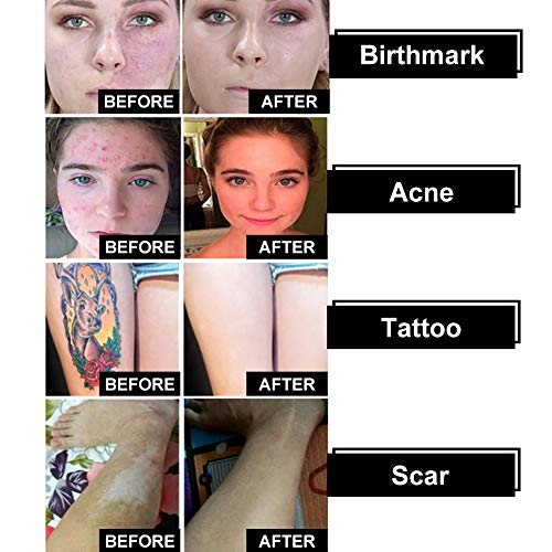 Tattoo Concealer, Makeup Concealer, Scar Concealer, Pro Concealer, Professional Waterproof Concealer Set, Cover Tattoo/ Scar/ Birthmark/ Vitiligo/ Bruise/ Acne, Tattoo Cover up Makeup/Body Concealer