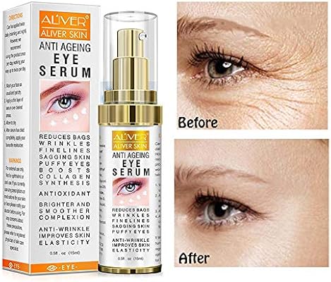 best eye gel for wrinkles