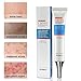 Acne Cleaning Cream,Acne Treatment Gel,Acne Removal Cream,Acne Gel Essence Skin Repair Face Cream,Natural Treatment Gel for Facial Blackhead Acne,Removes Spots Calms Inflammation