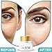 Eye Cream For Dark Circles and Puffiness - Anti Aging Wrinkle Remover Eye Gel - Under Eyes Treatment for Men and Women