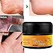 Taykoo Horse Oil Premium Cracked Heel Balm Cream For Rough Dry & Cracked Chapped Feet Heel Skin,Moisturizing Cream For Adults And Kids