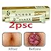 Hemorrhoids-Cream-DICTAMNI-Antibacterial Cream Chinese Herbal for Treatment Hemorrhoids Cream（2pcs）