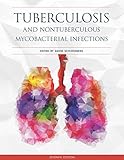 Tuberculosis and Nontuberculous Mycobacterial Infections