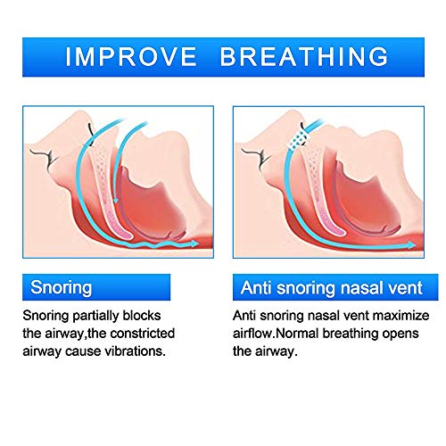 Snoring Solution,Stop Snoring Anti Snoring Nose Vents Plugs Nose Dilator Snoring Sleep Aid for Men and Women 8pcs