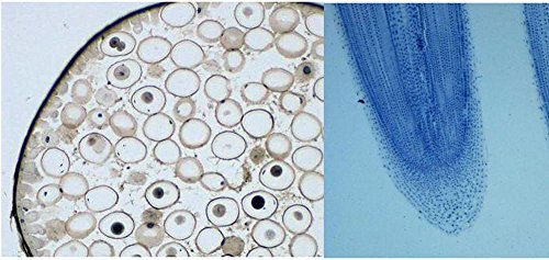 Prepared Slides, Plant and Animal Mitosis Comparison