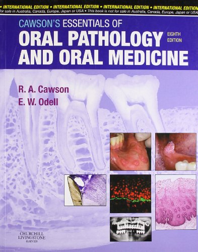 Cawson's Essentials of Oral Pathology and Oral Medicine