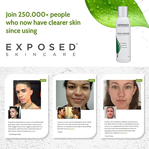 Exposed Skin Care Acne Facial Cleanser Gentle Face Wash with