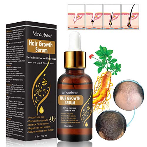 Hair Growth Serum, Hair Treatment Serum Oil, Hair Serum, Hair Growth Treatment, Stops Hair Loss, Thinning,Balding, Promotes Thicker, Fuller and Faster Growing Hair (30ML)