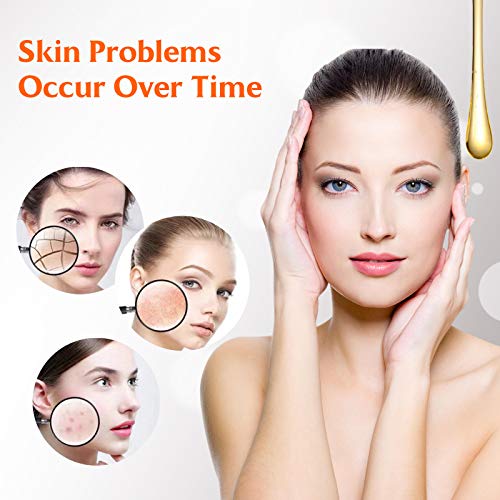 Vitamin C Serum For Face, Natural Moisturizing & Anti Acne Serum, Anti Aging Facial Serum, Reduce Appearance Of Wrinkles, Dark Circles, Fine Lines, Sun Damage