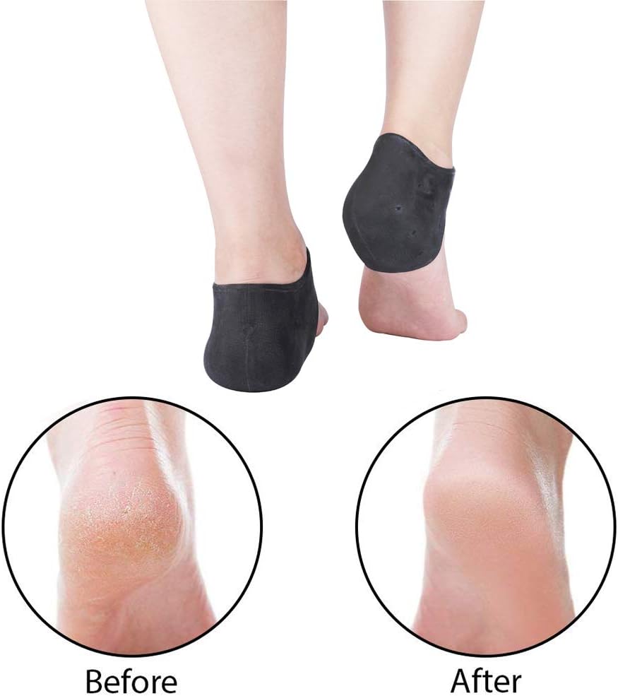 Plantar Fasciitis Inserts Pads,Gel Heel Cushion,Silicone Heel Protectors,Heel Guards and Heel Cups Great for Plantar Fasciitis,Cracked Heels, Achilles Tendinitis & Heel Sore, for Women & Men.: Health & Personal Care