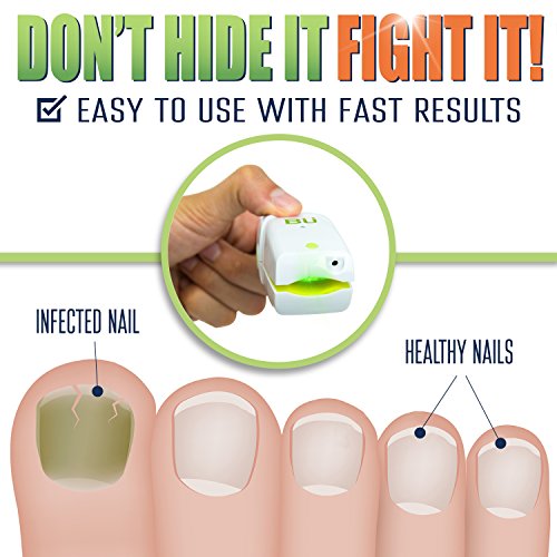 Nail Fungus Laser Treatment + Free Shoe UV Sterilization Kit, Treatment