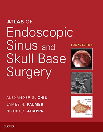 Atlas of Endoscopic Sinus and Skull Base Surgery E-Book - //medicalbooks.filipinodoctors.org