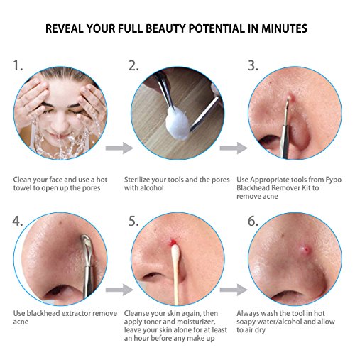 6 Blackhead+Fypo+Extractor+Professional+Stainless