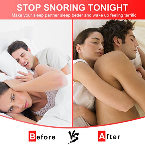 Anti Snoring Devices Snoring Solution, 4 Set Snore Stopper Nose Vents Nasal Dilators Anti Snoring Stop Snoring Solution Anti-Snoring Sleep Aid Device Snore Reduction for Men Women