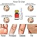 HELLOYOUNG Mole & Tag Removal Solution Mole Dark Spot Removal Wart Tag Freckle Removal Cream Oil PlasterOintmentsthumb 4