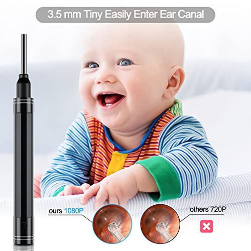 Nazano Ear Endoscope,Ear Wax Remover Tool,WiFi Visual Ear Cleaner 3.5mm with 1080P HD Ear Camera,8 Ear Picks for Kids and Adults,Compatible with iPhone, iPad, Android Phones & Tablets