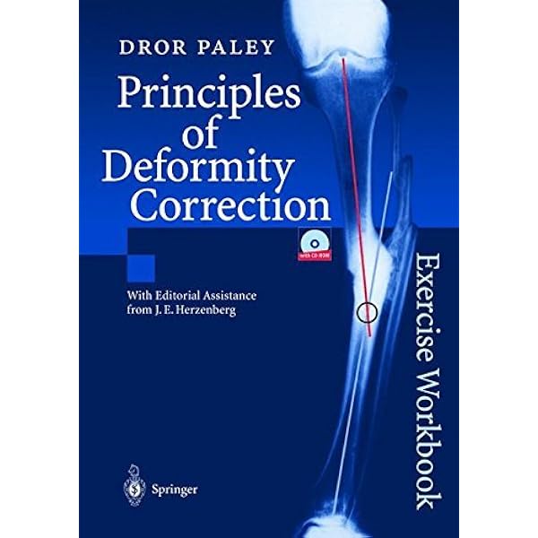 Principles of Deformity Correction: Exercise Workbook