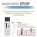 Blackhead 3 Step Kit, LuckyFine - Skin Care Peeling Treatment Mask, Pore Cleanser Shrinking Pores Black Head Remover