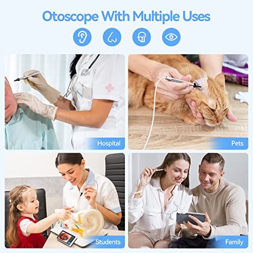ScopeAround Otoscope Ear Camera with 4.5" IPS Screen, 1920x1080 FHD