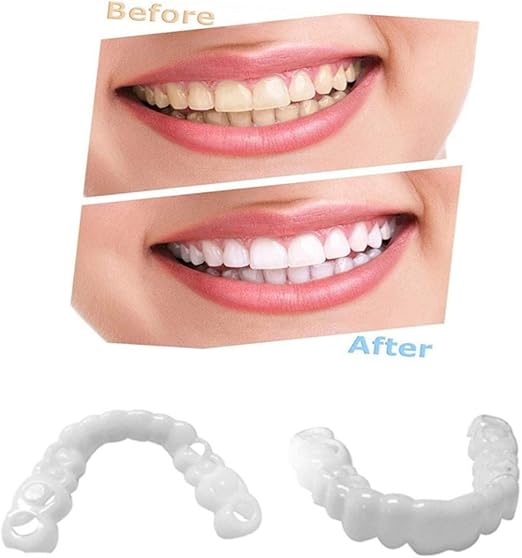 NMJDSSS Veneer Kosmetische Zähne Prothese Weiß Simulierte Kosmetische