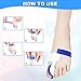 Bunion Corrector, Bunion Corrector & Bunion Relief Protector Kit, Toe Spacers Alignment Straightener Splint Treat Pain in Hallux Valgus, Tailors Bunion, Big Toe Joint, Hammer Toe (2 PCS)