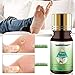 Wart Remover, Stops Wart Regrowth, Wart Removal, Painlessly Removes Common and Plantar Wartsthumb 3