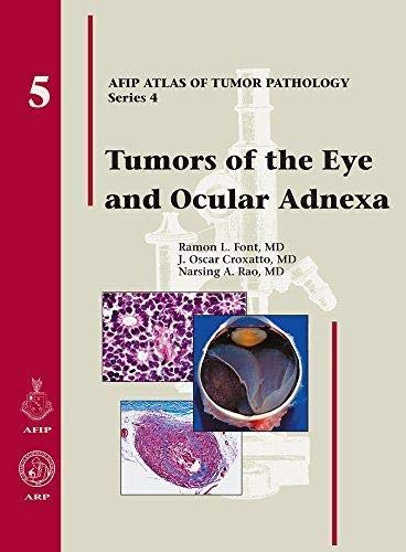 Tumors Of The Eye And Ocular Adnexa Afip Atlas Of Tumor Pathology Font Ramon L M D Croxatto J Oscar M D Rao Narsing A Amazon Com Books