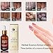 Hunputa Fungus Stop. Effective against 99.9% of nail fungus.Anti fungal Nail Solution. Toenails & Fingernails Solution.